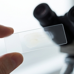 La dysfonction érectile peut-elle entraîner une baisse du nombre de spermatozoïdes ?
