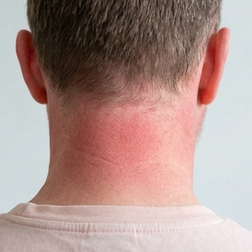 Quels sont les effets secondaires du sildénafil ?