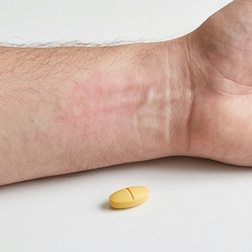 Est-ce que cialis cause des rougeurs au visage et des éruptions cutanées ?